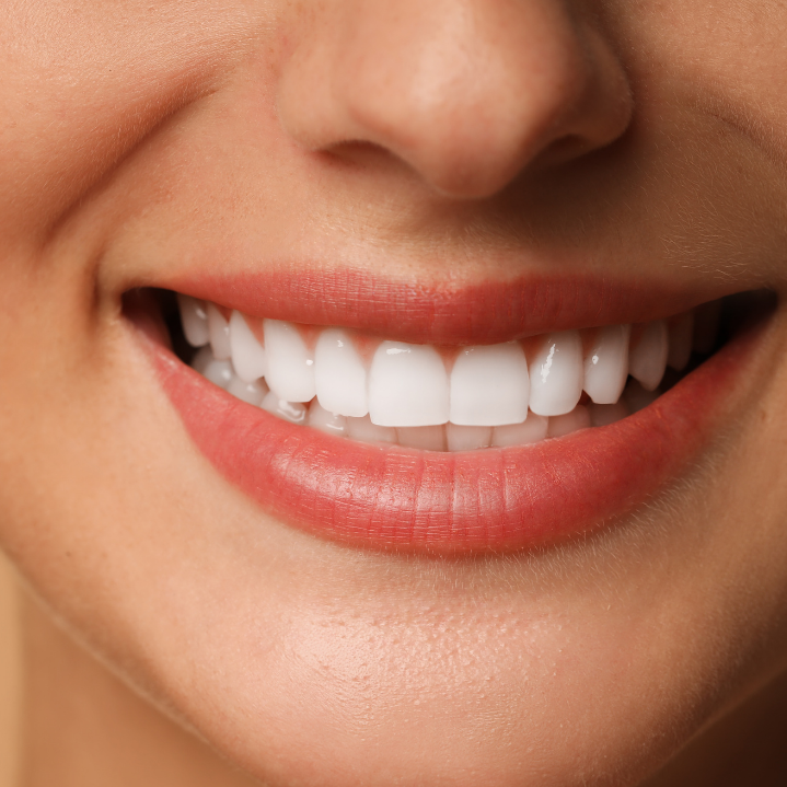 Full Mouth Rehabilitation